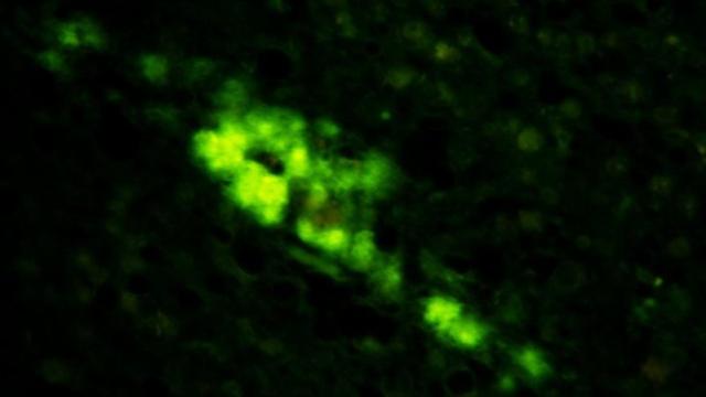Synthetic Brain-Destroying Human Prions Created In The Lab For The First Time