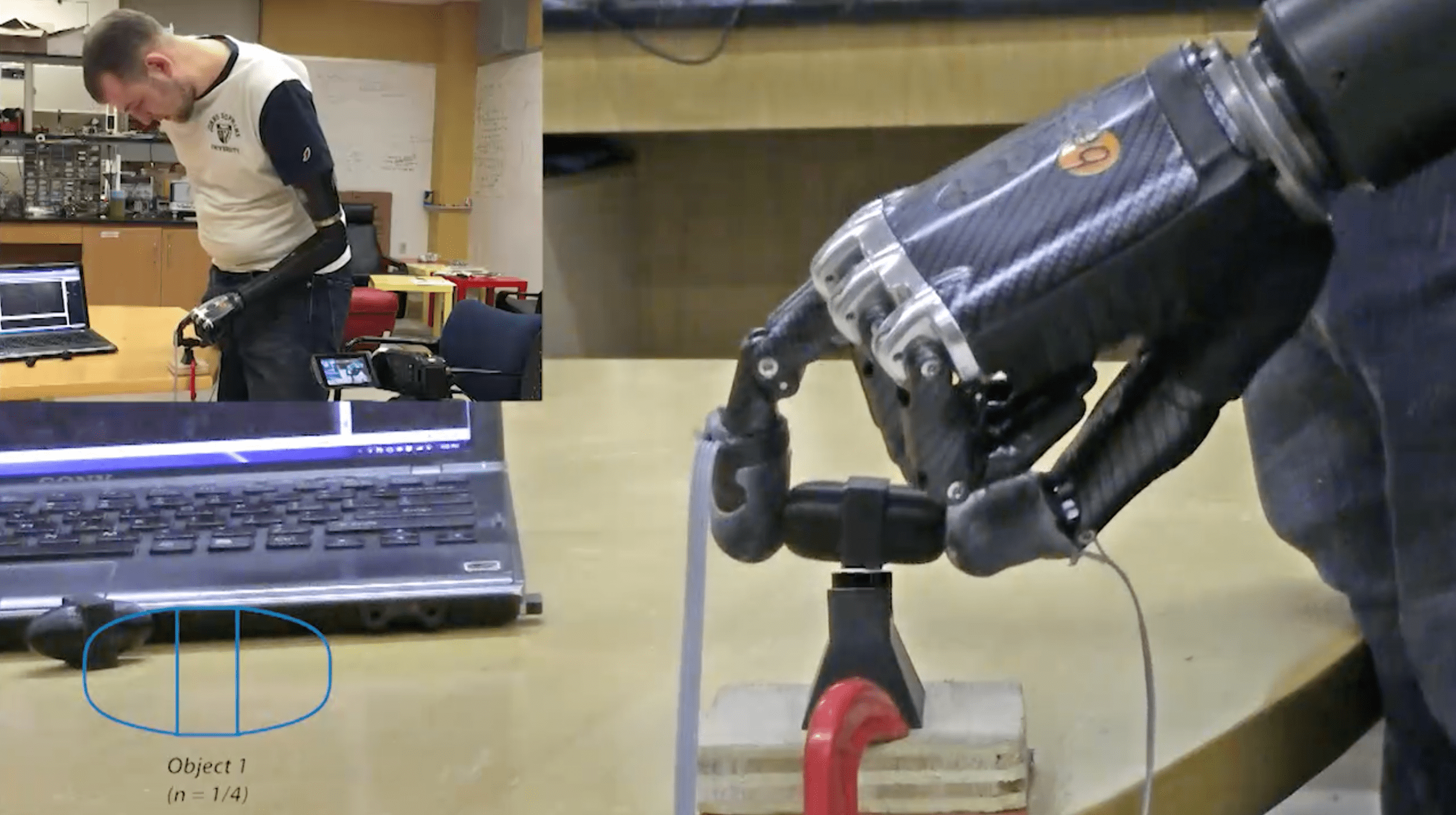 ‘Electronic Skin’ Allows User Of Prosthetic Hand To Feel Pain