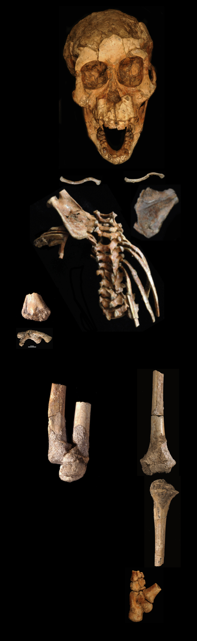 A Toddler Who Lived 3 Million Years Ago Could Walk Upright And Capably Climb Trees