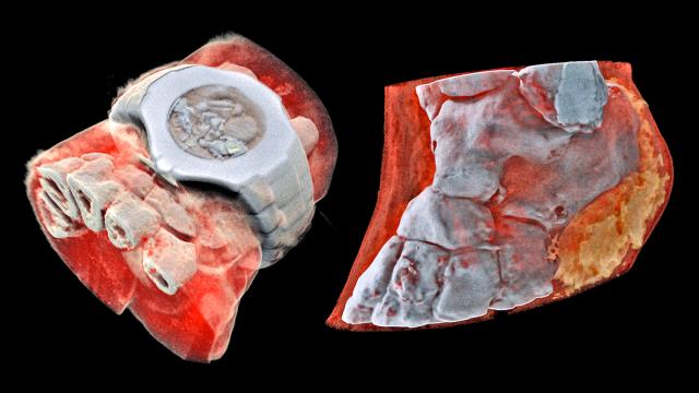 The World’s First Full-Colour, 3D X-rays Are Freaking Me Out