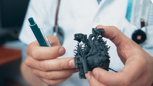How Cardiologists Use 3D Printing To Save Tiny Lives