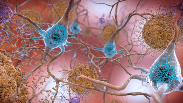 European Scientists Have Made An Intriguing Discovery In Alzheimer’s Drug Research