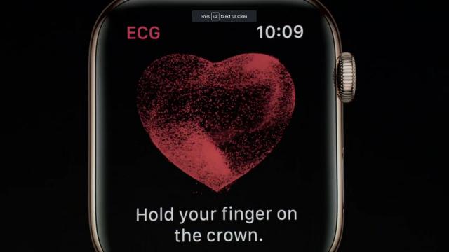 Aussie Apple Watches Won’t Get That Cool Heart Monitoring Function