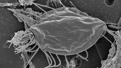 Bizarre Microbes Represent A Major New Branch On The Evolutionary Family Tree
