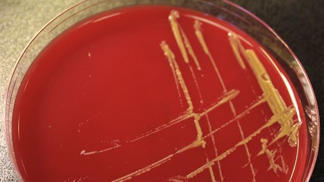 Bad Plumbing Helped Cause A Strange Outbreak Of Antibiotic-Resistant Bacteria At A Maryland Hospital