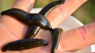 Some Pressing Questions About The 3,950 Illegally Imported Leeches Currently Stuck In Canada