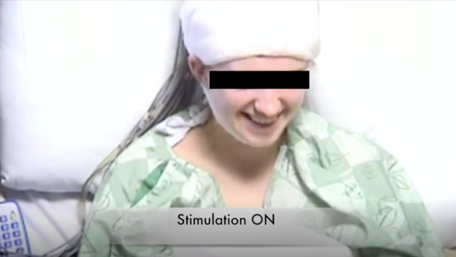 Doctors Zap The Brains Of Awake Brain Surgery Patients To Make Them Laugh And Have Fun