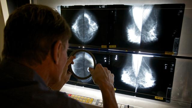 A Major Change To How Doctors Talk About Mammogram Results Is Coming Soon