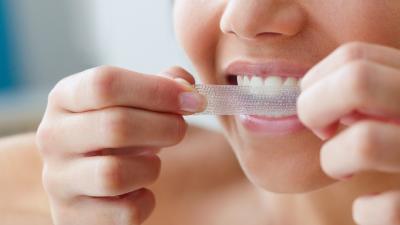 Teeth-Whitening Products Might Be Riskier Than We Thought