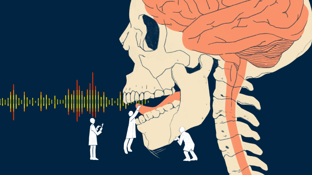 Vocal Tract Simulator Translates A Person’s Brain Activity Into Clear Sentences