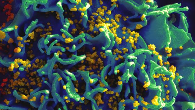 Researchers Use CRISPR To Remove HIV From Mice