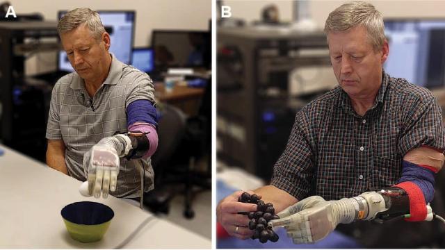 Scientists Have Created A Prosthetic Arm That Lets Patients Feel Touch Again