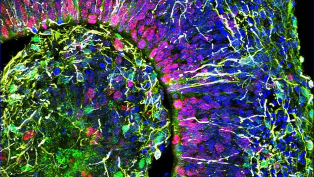 Scientists See Human-Like Brain Waves In Lab-Grown Mini-Brains