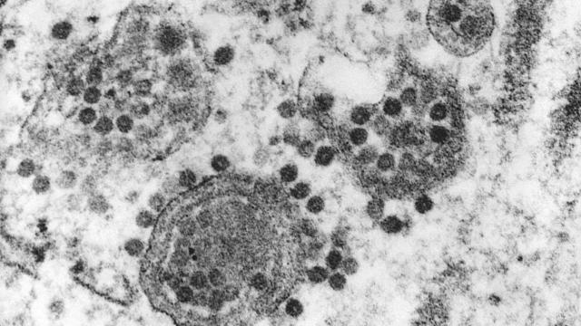 Three Americans Have Died After Contracting Rare Brain-Infecting Virus Spread By Mosquitoes