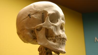 Your Bones Secrete A Hormone That Can Make You Panic, Scientists Find