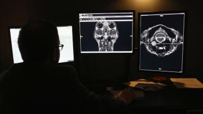 Anyone Can Look At Millions Of Americans’ Medical Images And Data, Report Finds