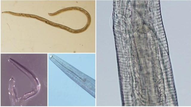 A Second Woman Has Gotten Parasitic Eye Worms, And Surely We’re All Next