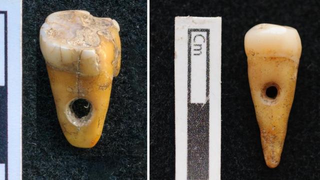 Prehistoric Turks Wore Human Teeth As Jewellery, Rare Discovery Reveals