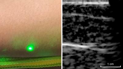 MIT Engineers Create Laser Ultrasounds That Can Look Inside Your Body Without You Even Feeling It