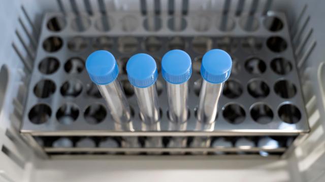 Researchers In The US Are Starting Door-to-Door Coronavirus Testing