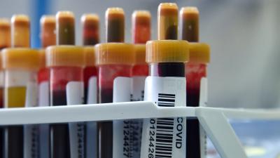 The CDC Is Screwing Up How The U.S. Counts Covid-19 Testing Numbers