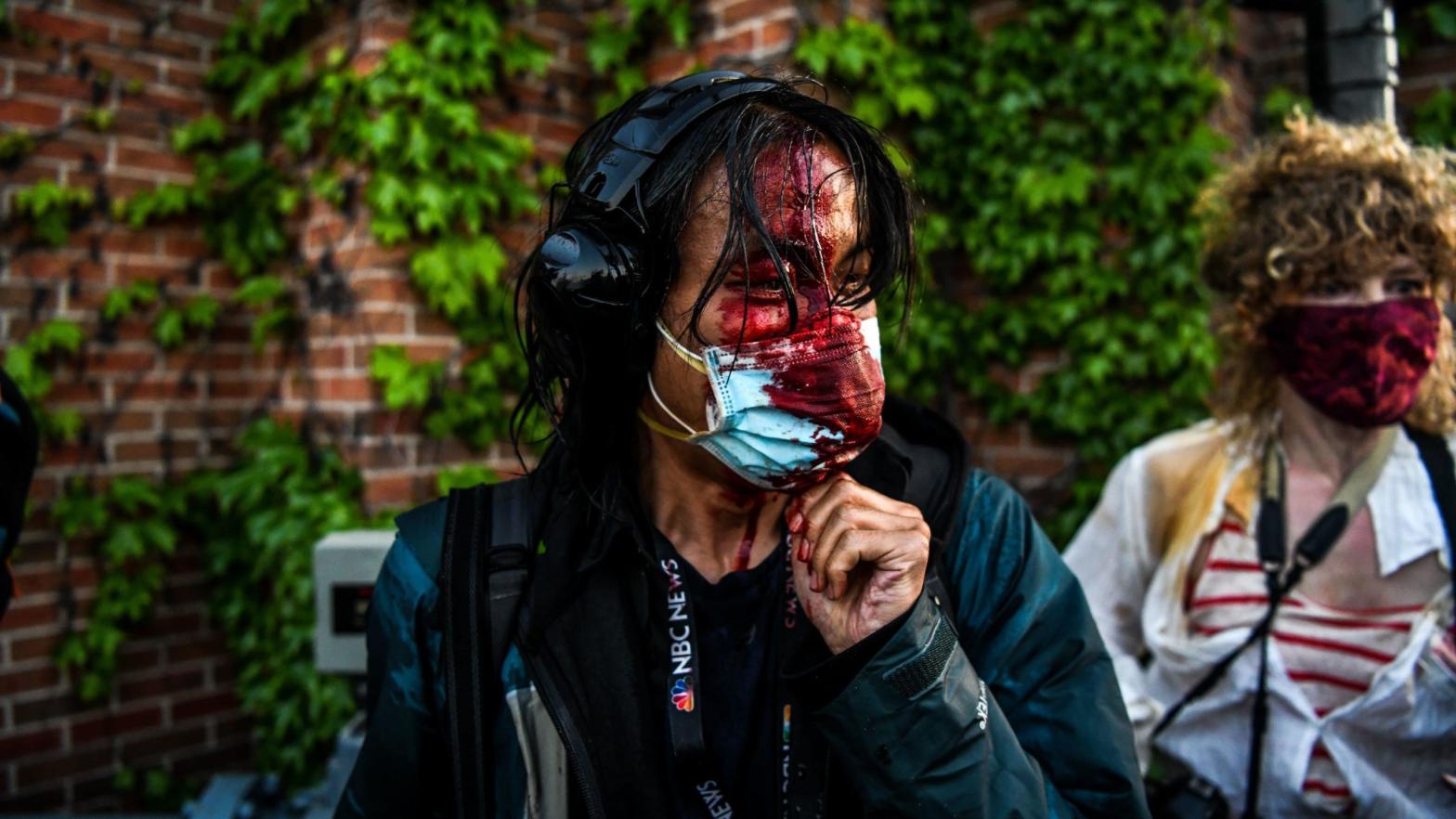 A journalist is seen bleeding after police started firing tear gas and rubber bullets near the 5th police precinct following a demonstration to call for justice for George Floyd, a black man who died while in custody of the Minneapolis police, on May 30, 2020 in Minneapolis, Minnesota. (Photo: CHANDAN KHANNA/AFP, Getty Images)