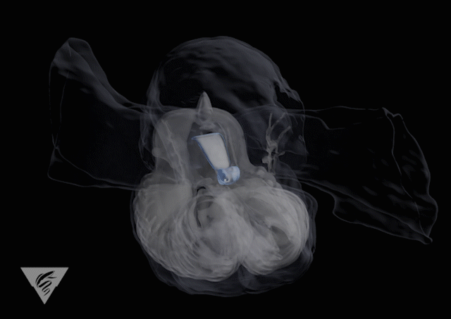 This animation shows the first ever 3D reconstruction of a giant larvacean, and revealing the complex structure of its inner filter. The animation was made in collaboration with the Digital Life Project at the University of Massachusetts. (Image: MBARI)