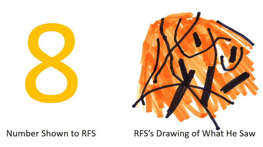 Since 2011, the patient known as RFS has only been able to see wavy lines when looking at the digits 2 through 9.  (Photo: Johns Hopkins University)