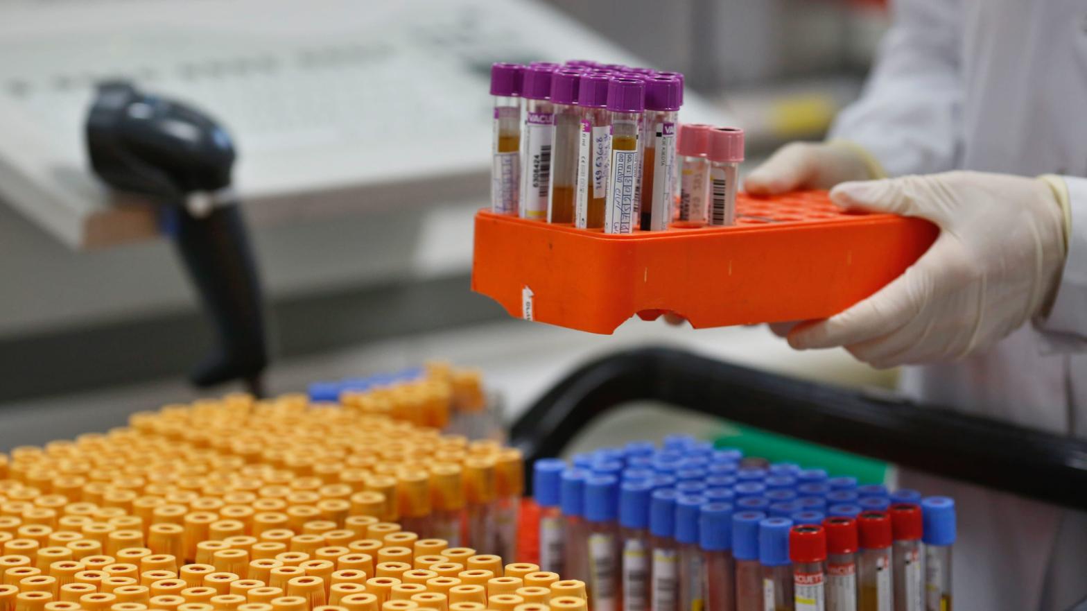 A lab technician preparing blood samples for covid-19 antibody testing.  (Photo: Gil Cohen, Getty Images)