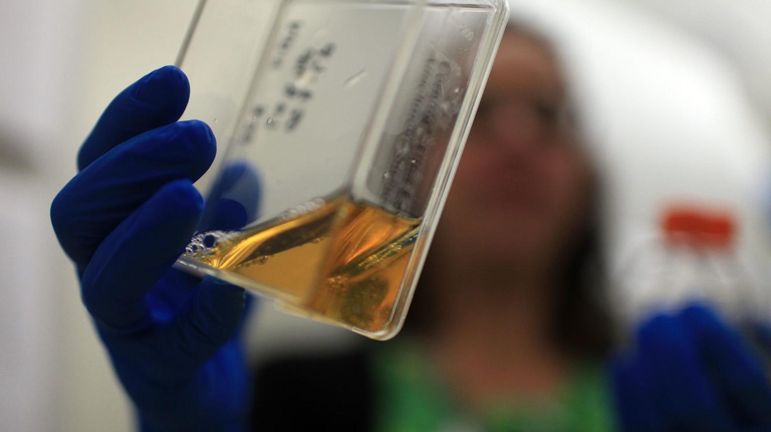 A researcher holding up a container of stem cells. (Photo: Spencer Platt, Getty Images)