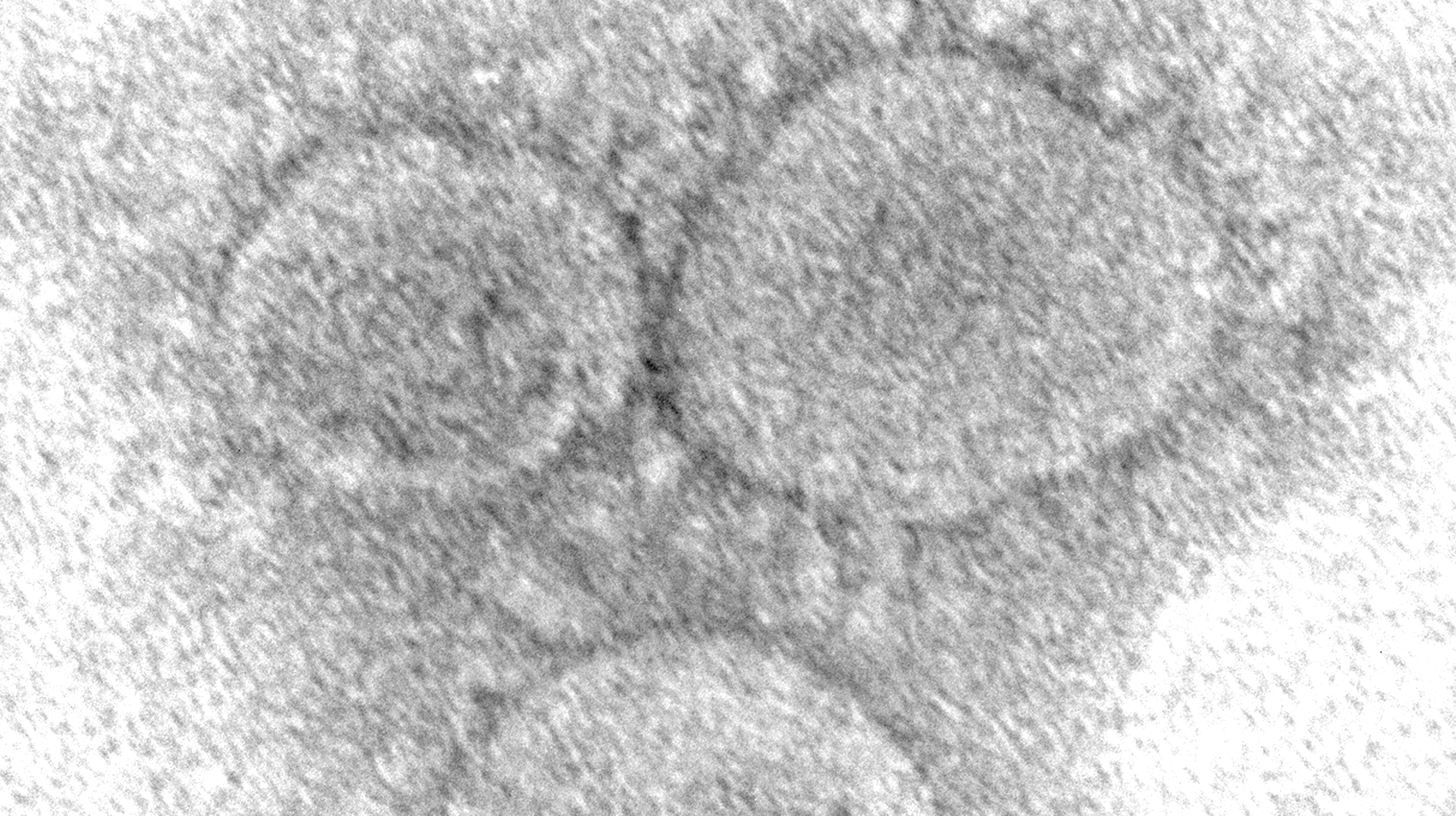 An electron microscopic image of SARS-CoV-2, the virus that causes covid-19  (Image: CDC/ Hannah A. Bullock and Azaibi Tamin)