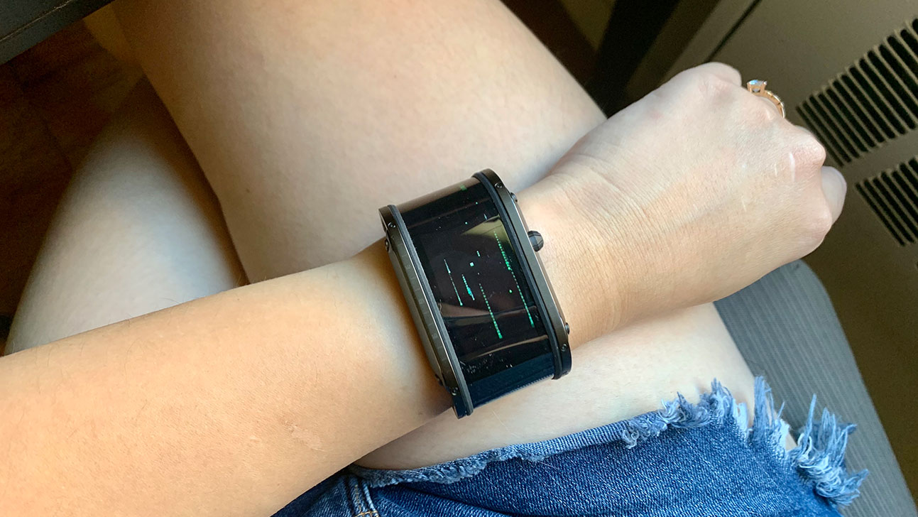 Never mind the obvious farmer's tan! This watch is huge! (Photo: Victoria Song/Gizmodo)