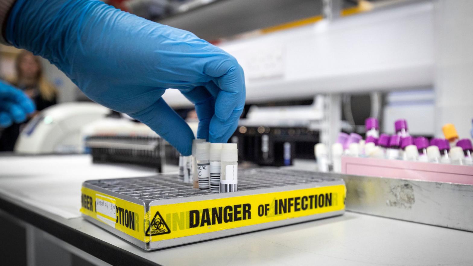 A lab technician extracting viruses from swab samples in the coronavirus testing laboratory at the Glasgow Royal Infirmary in Scotland, taken February 19, 2020.  (Photo: Jane Barlow, Getty Images)
