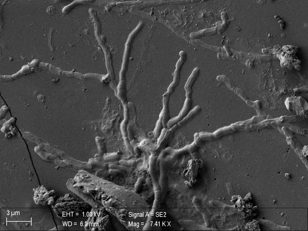 A scanning electron microscope image showing what appears to be worm-like axons sticking out from neuronal cells.  (Image: Pier Paolo Petrone)