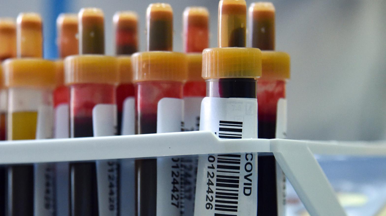 Blood samples about to be tested for covid-19 antibodies at a clinic in Moscow on May 15, 2020 (Photo: Vasily Maximov, Getty Images)