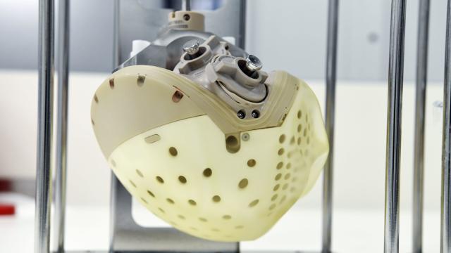This Next-Gen Artificial Heart Is Set to Go on Sale This Year