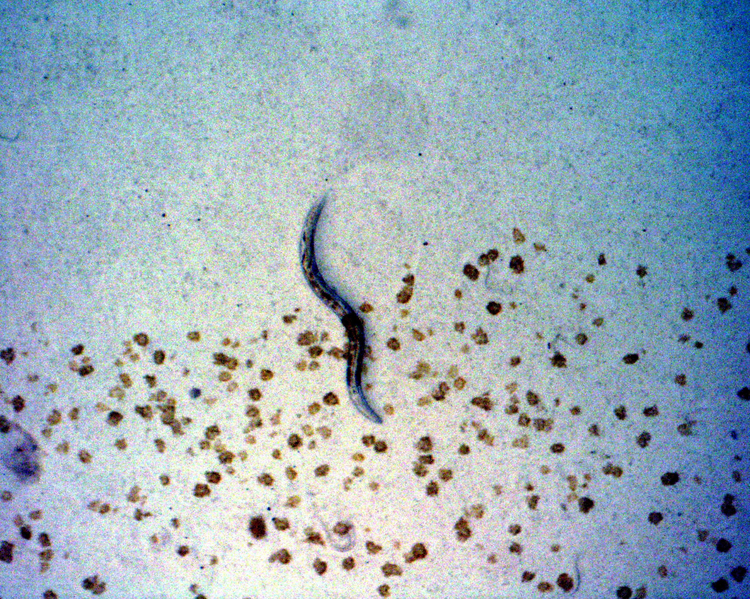A nematode that was in space and survived the Space Shuttle Columbia crash in 2003. (Photo: Volker Kern/NASA/Getty Images, Getty Images)