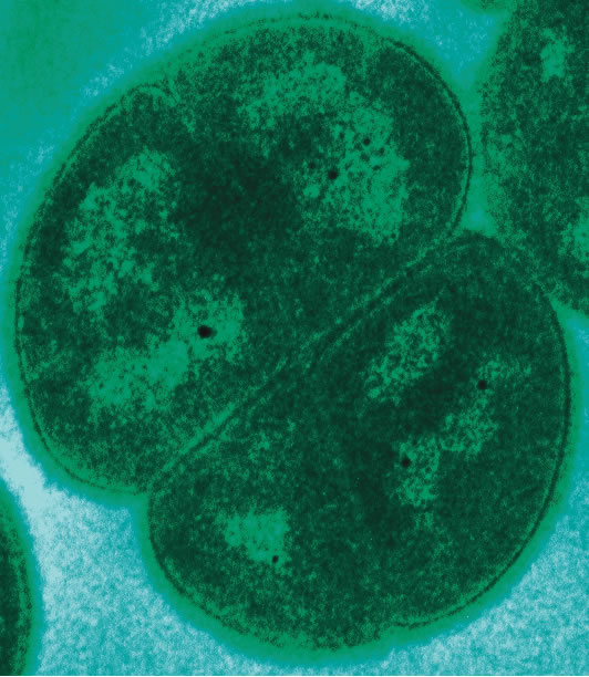 Transmission electron microgragh of Deinococcus radiodurans (Image: Michael Daly/Uniformed Services University)