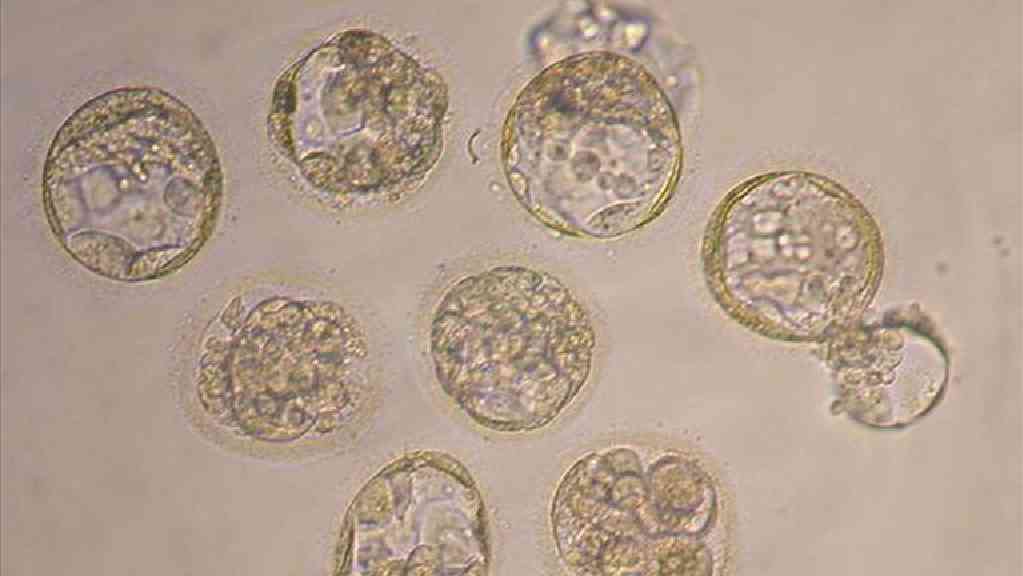 Human embryos. (Image: AP, AP)