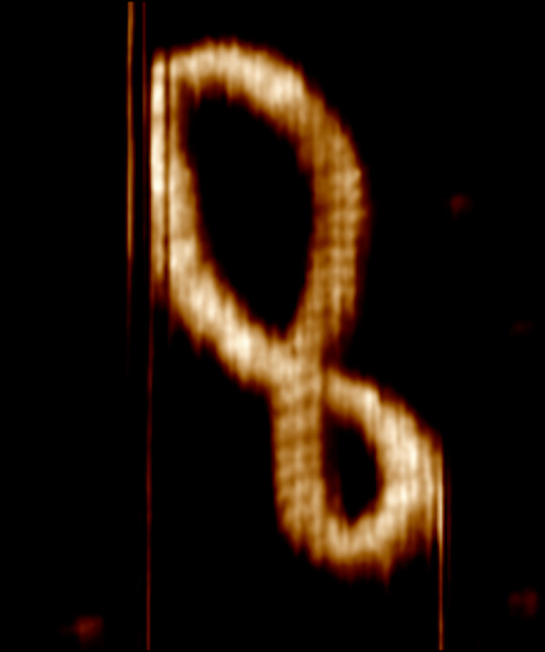 Atomic force microscopy image of a DNA minicircle. (Image: A. L. B. Payne et al., 2021/Nature Comm)