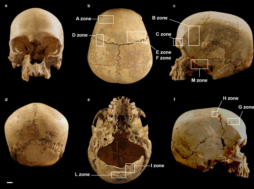 Multiple view of the cranium.  (Image: Belcastro et al, 2021, PLOS ONE)