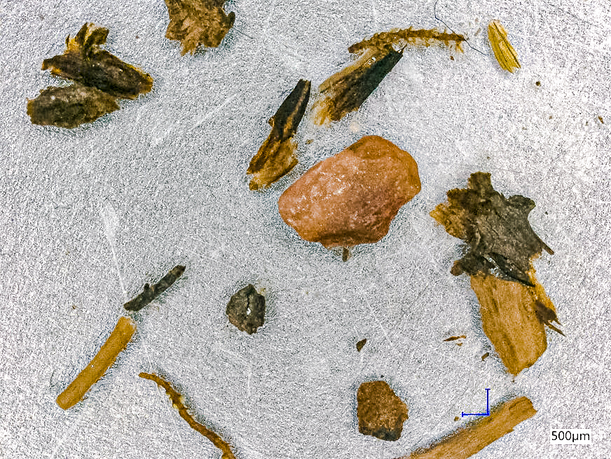 A microscopic view of twigs and moss from the dirt sample.  (Image: University of Vermont)