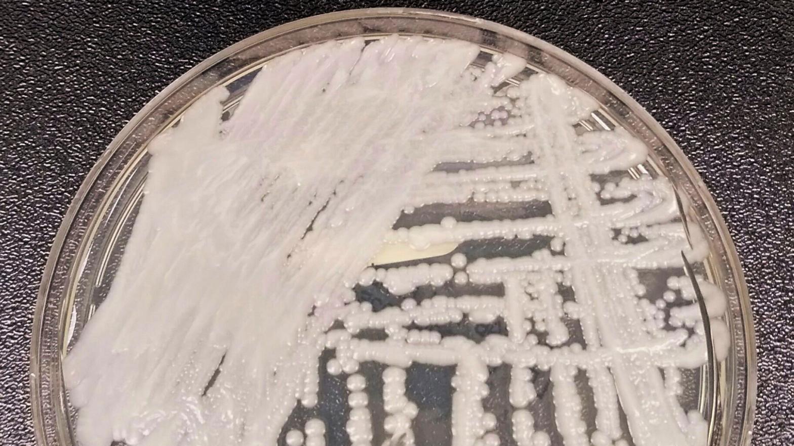 A strain of Candida auris being cultured in a petri dish at a CDC laboratory. (Photo: Shawn Lockhart, AP)