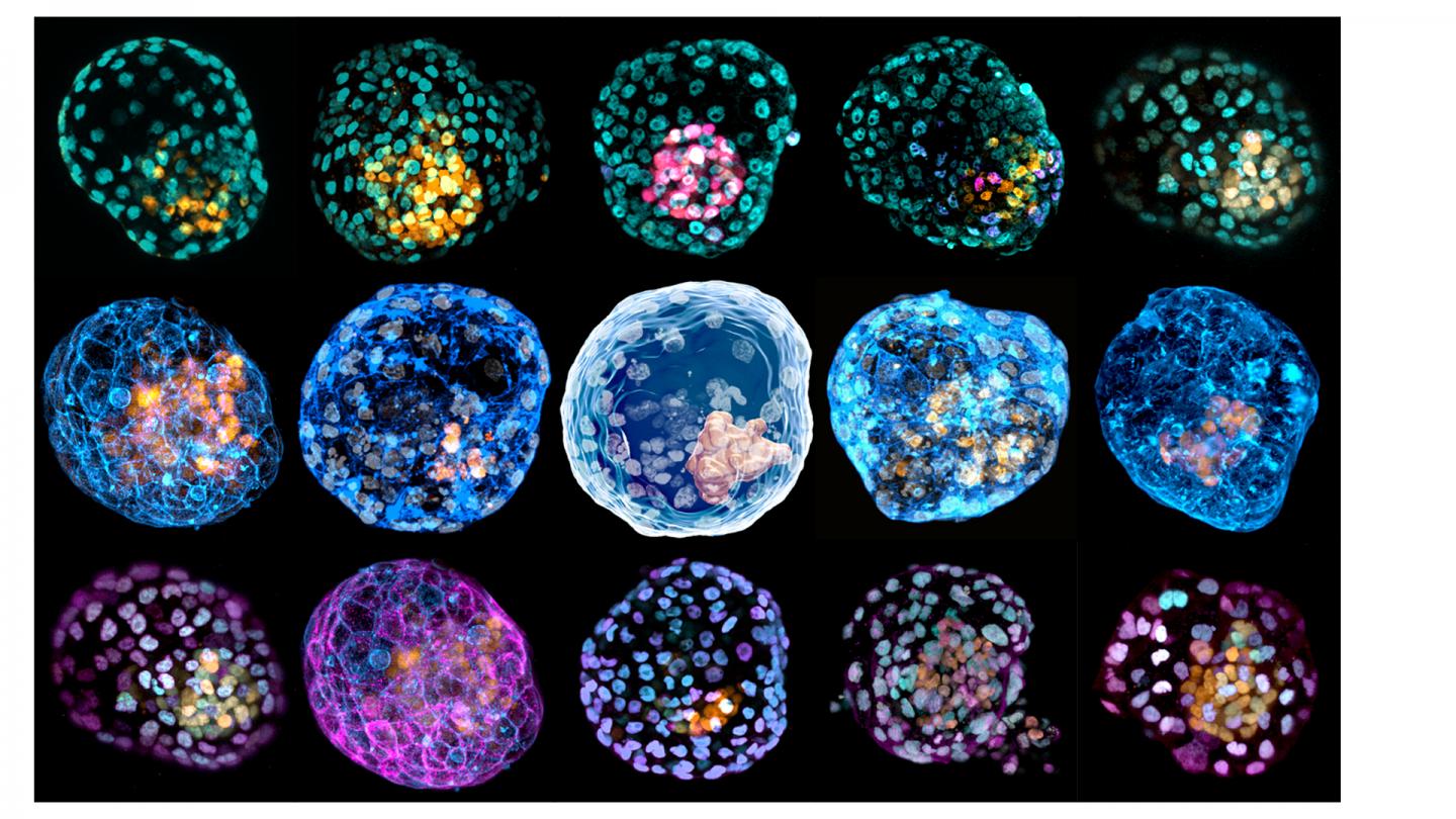 Stained iBlastoids, the synthetic structures that mimic human blastocysts. (Image: Monash University)