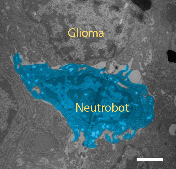 A neutrobot nestled up against a glioma tumour in a mouse brain. (Image: Zhang et al., Sci Robot. 6, eaaz9519 (2021))