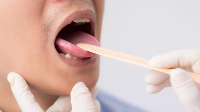 Doctors Excited to Find ‘Rare’ Forked Uvula in Florida Man