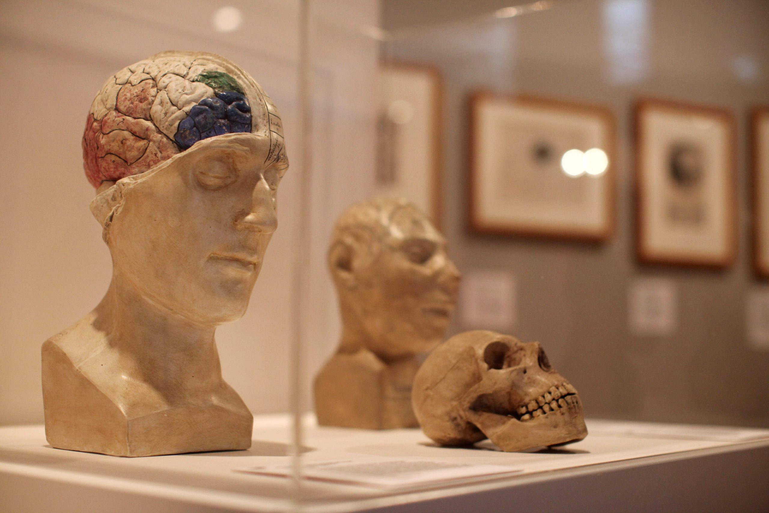 A skull displayed at the Wellcome trusts 'Brains' exhibition at the Wellcome Collection on March 27, 2012 in London, England.  (Photo: Dan Kitwood, Getty Images)