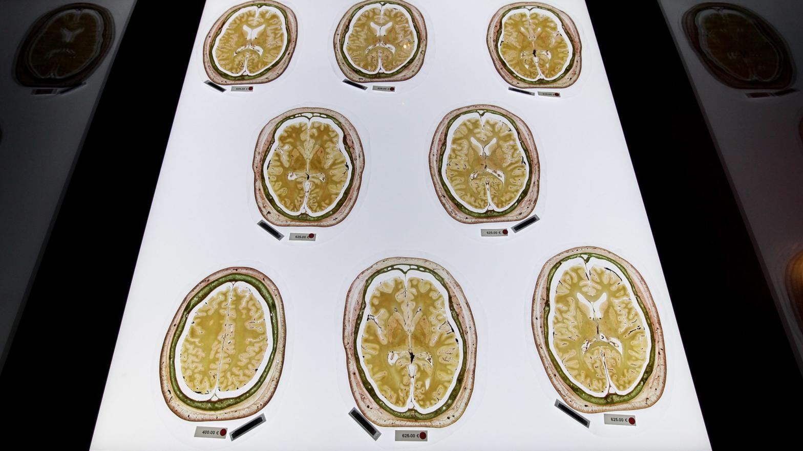 Plastinated slices of the human brain exhibited at the Plastinarium, a museum, teaching centre, and body preparations facility created by anatomist Gunther von Hagens, in Guben, Germany. (Photo: Sean Gallup, Getty Images)