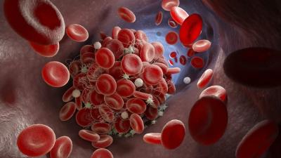 Blood Clot Risks: Comparing The AstraZeneca Vaccine And The Contraceptive Pill