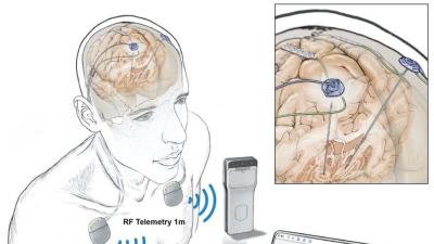 In a First, People Had Their Brain Activity Tracked Remotely During Everyday Life
